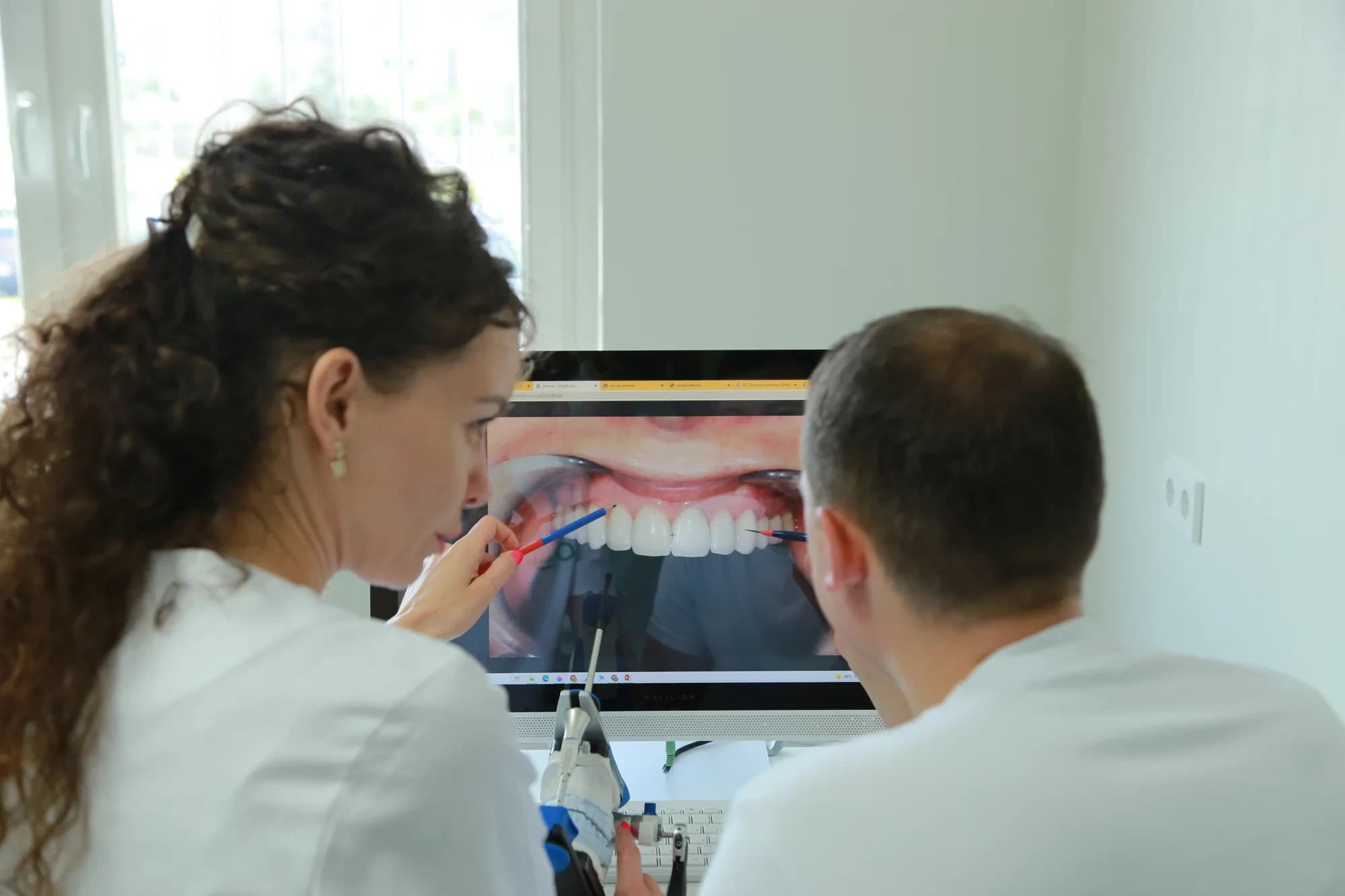 Врач и зубной техник планируют виниры по фото улыбки на мониторе